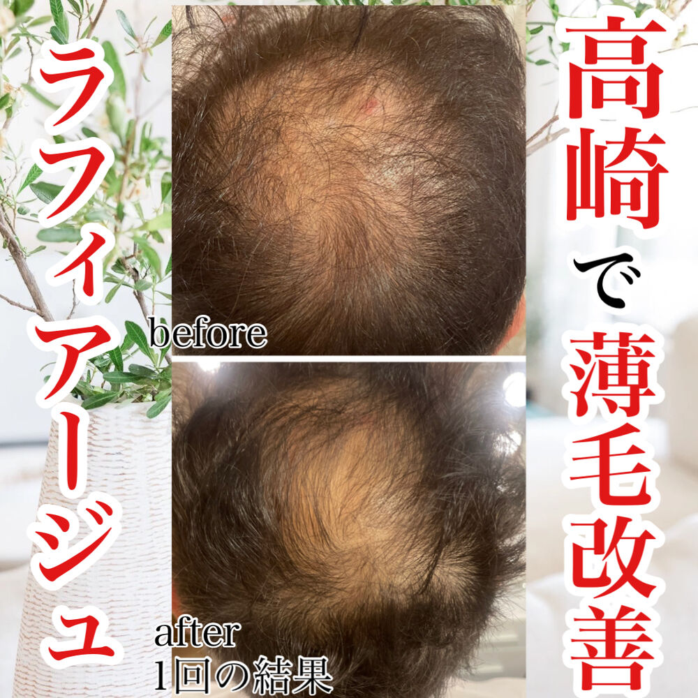 画像3360